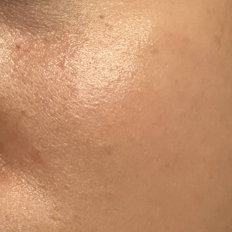 [잡담] 나 피부가 이런데 집에서 무슨 어떤 관리 해 줘야해? 40 | 인스티즈