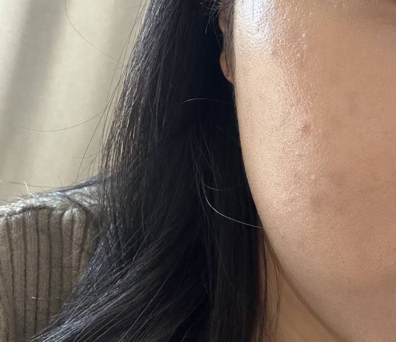 [잡담] 이런 피부는 뭘해줘야돼...? 오돌토돌... | 인스티즈