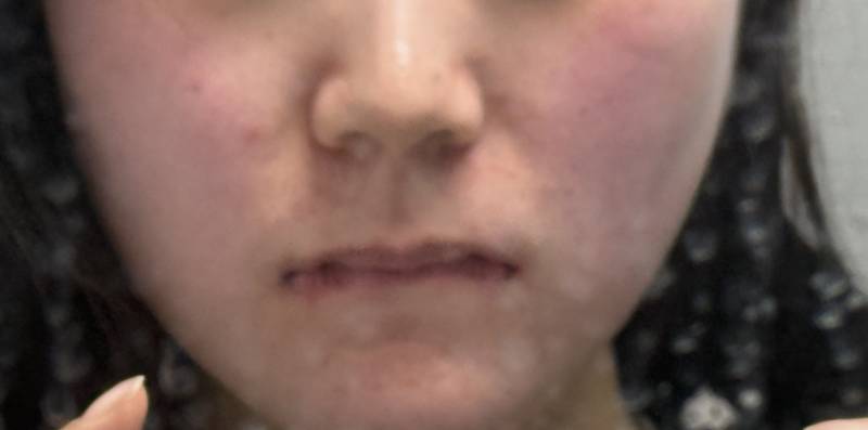 [잡담] 홍조 ㄹㅈㄷ 뭔 아기임? | 인스티즈