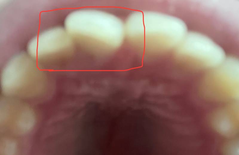 [잡담] 교정 할말 | 인스티즈