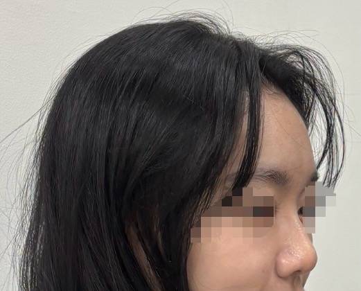 [잡담] 이런 코는 낮은 코에 속한다고 봐야하나? | 인스티즈