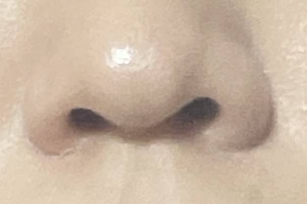 [잡담] 콧구멍 비대칭어떡해.. | 인스티즈
