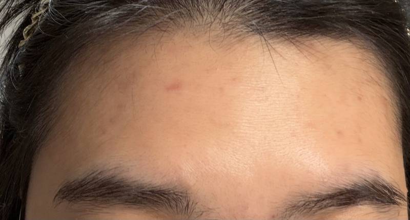 [잡담] 나 탈모야??? | 인스티즈