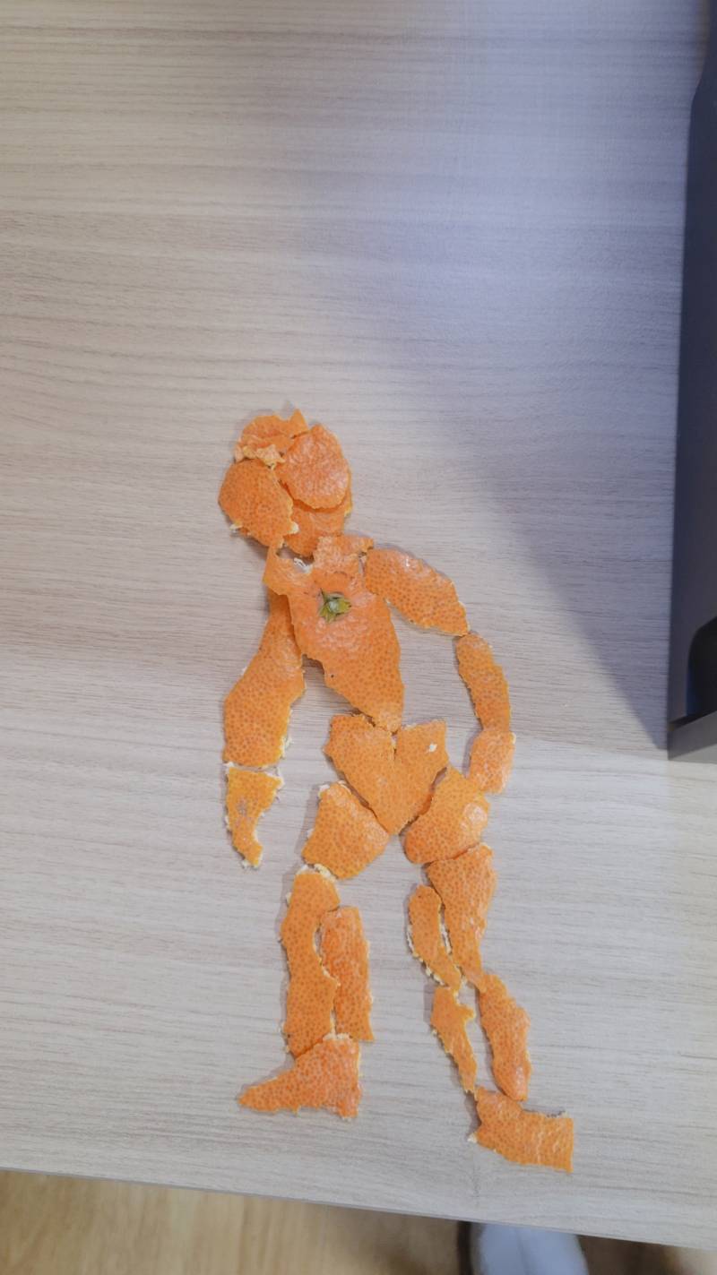 [잡담] 내친구 간호학과 실습중인데 정형외과거든? 뭐만들었대서보니깤ㅋㅋ | 인스티즈