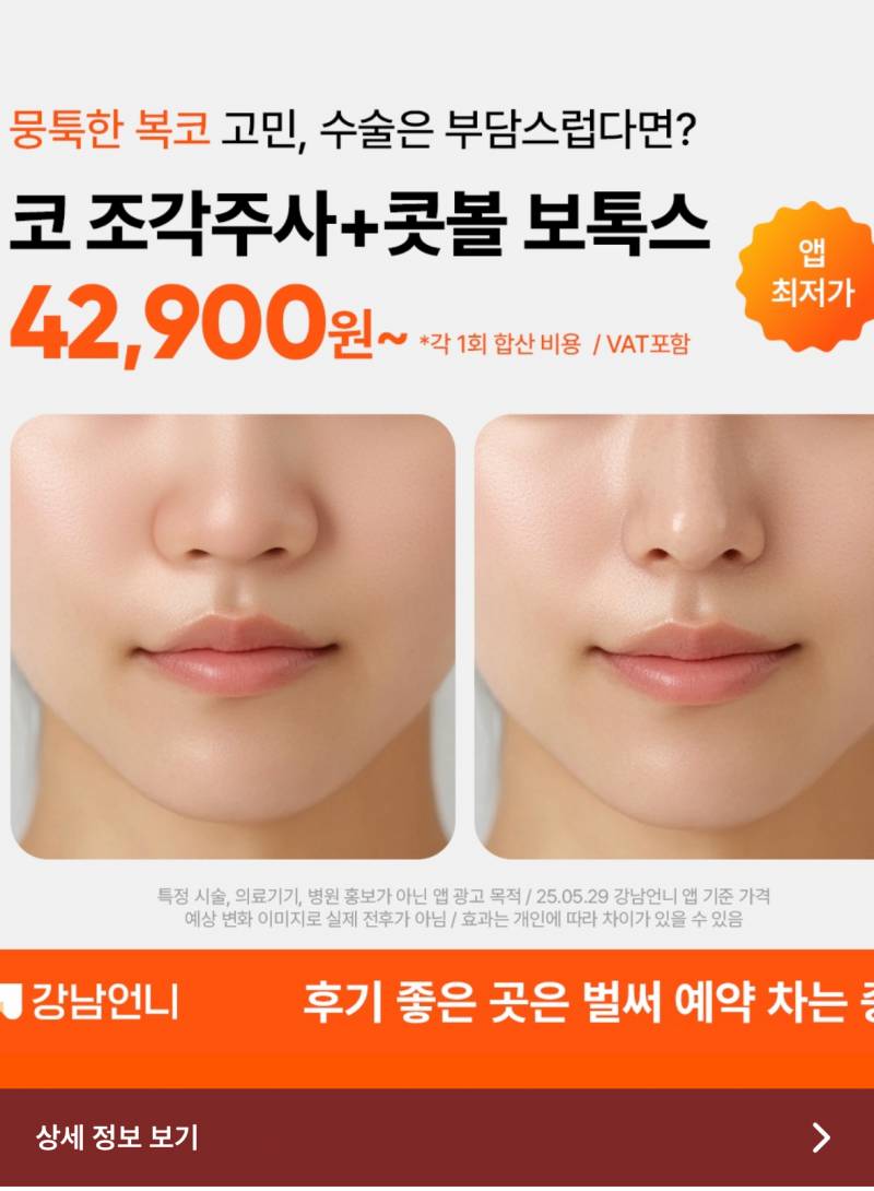 [잡담] 강남언니 광고 보는데 이거 진짜 효과 있엉❓❓ | 인스티즈