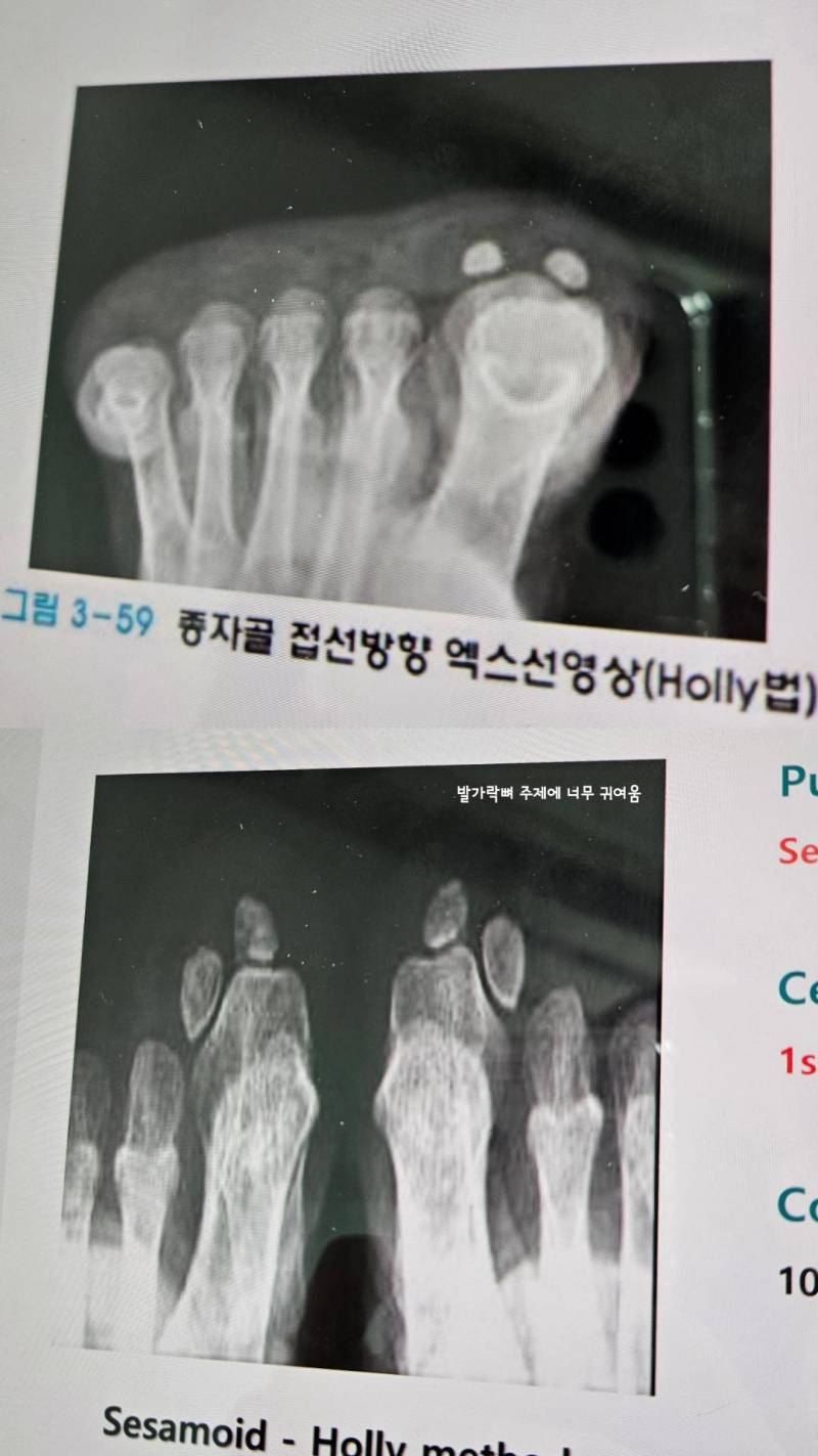 [잡담] 이 뼈 진짜 귀엽지않아?? | 인스티즈