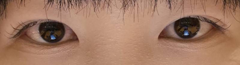 [잡담] 쌍수하고 청순해졌단 얘기 들었다~ | 인스티즈