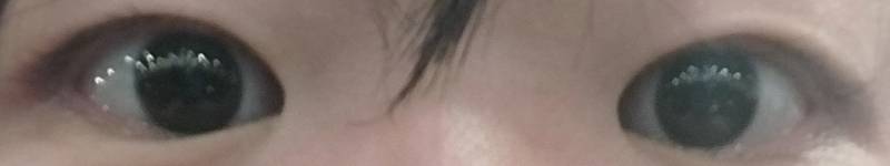 [잡담] 나 눈성형 뭐뭐할까 | 인스티즈