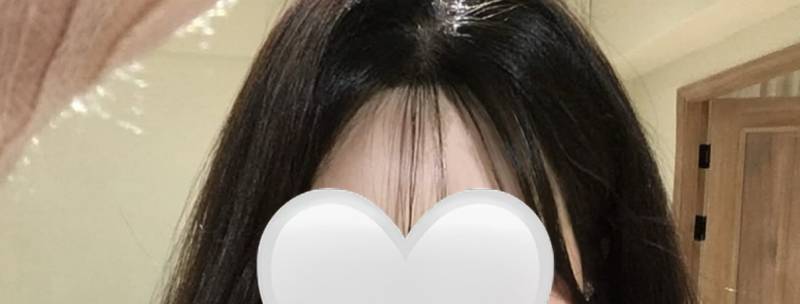 [잡담] 이런 옆머리 빈 곳은 어떻게 해야돼?ㅜㅜ | 인스티즈