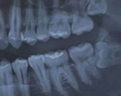 [잡담] 치과에서 일하는 익들 질문..! | 인스티즈