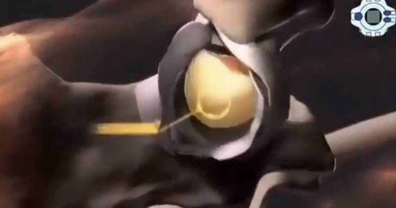 [잡담] 의학지식 풍부한 사람 들어와봐 이거 뭔지 알아? | 인스티즈