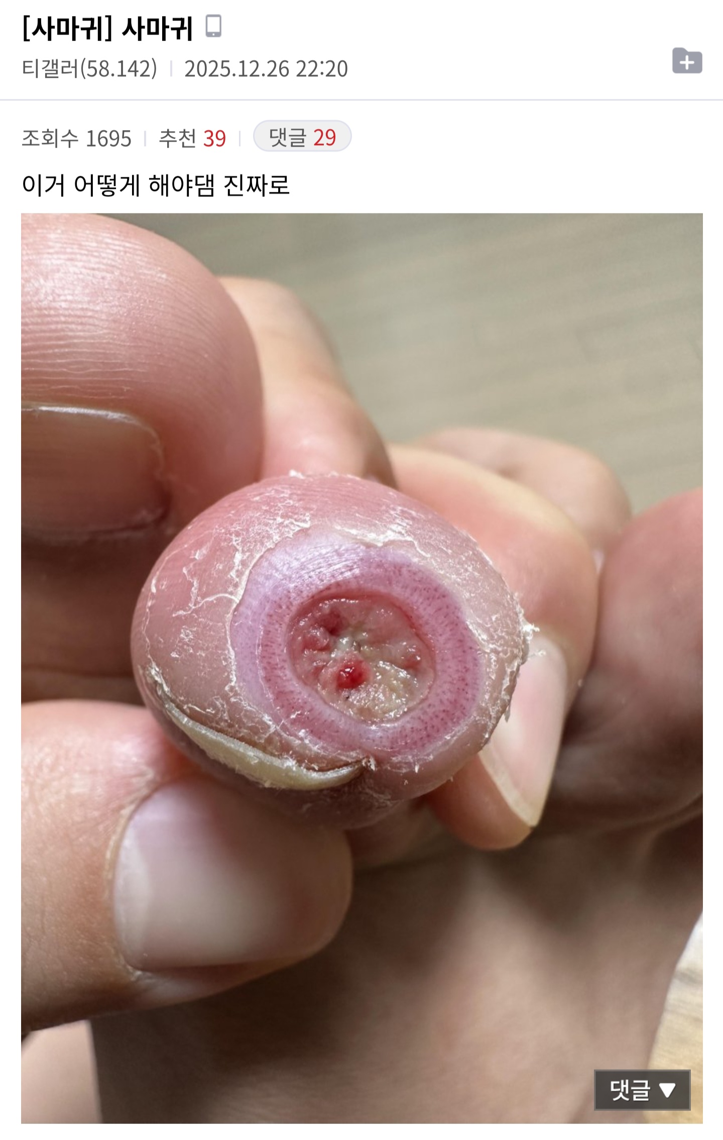 (혐오주의) 티눈갤러리 신흥강자 등장 | 인스티즈