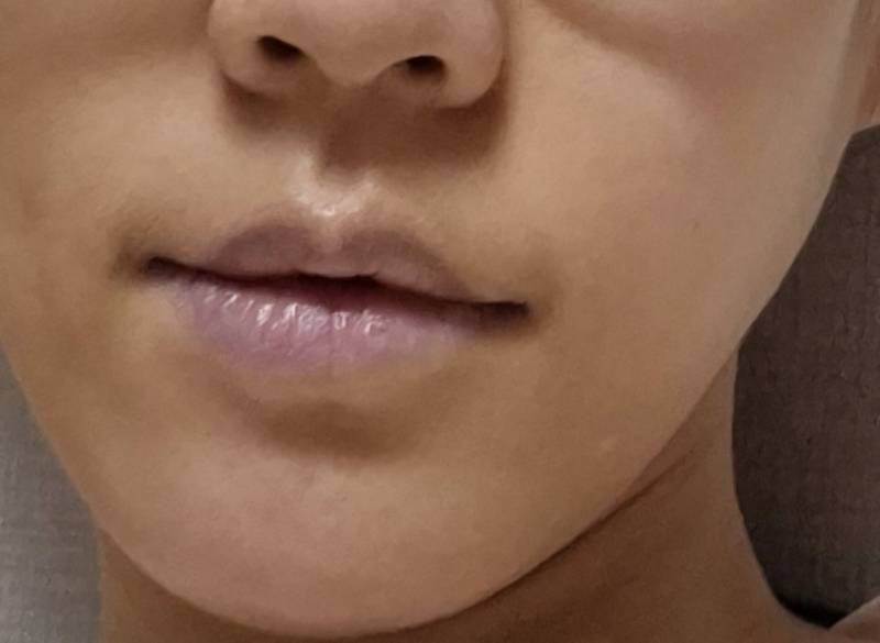 [잡담] 보라입술 나보다 심한사람 없을듯 | 인스티즈