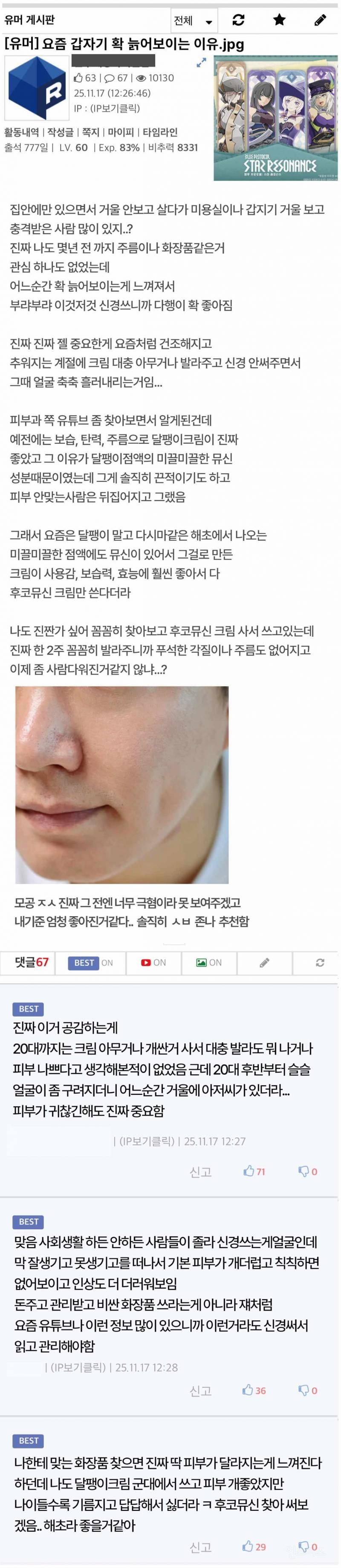 요즘 갑자기 확 늙어보이는 이유.jpg | 인스티즈