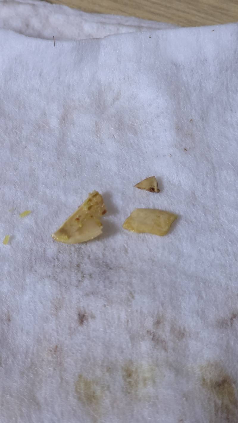 [잡담] 와 두쫀쿠 먹다가 이빨 나갈 뻔 했어 미친 | 인스티즈