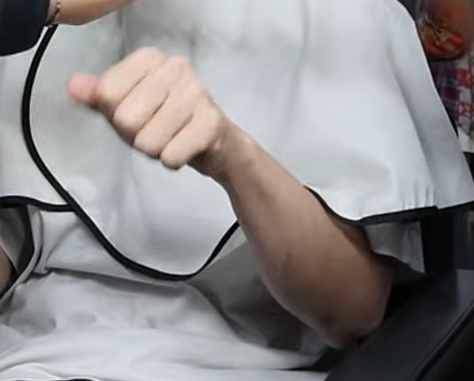 [잡담] 도경수 팔에 엄청 크게 흉터?생겼네 | 인스티즈