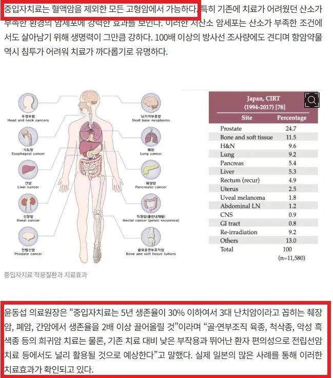 [잡담] 암 중입자치료 암 1-2기만 된다는거 진짜야? | 인스티즈