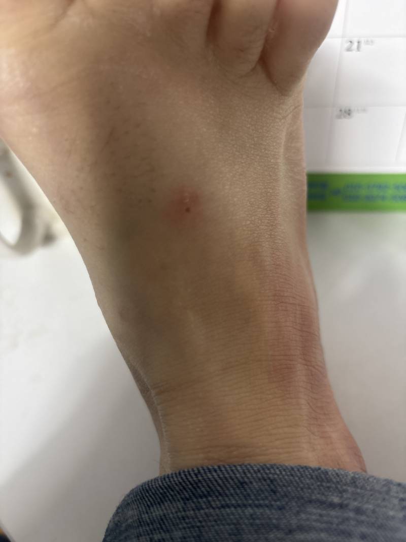 [잡담] 병원 가야 될정도임? | 인스티즈