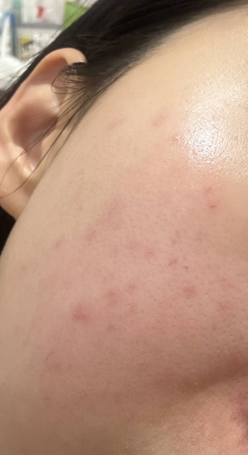 [잡담] 피부 관리 잘하는 사람들 제발제발 나 좀 도와줘.. | 인스티즈