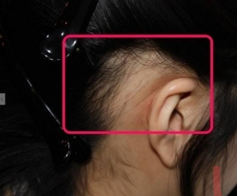 [잡담] 너네 저부분머리카락빽빽해? 수북해ㅡ??? | 인스티즈