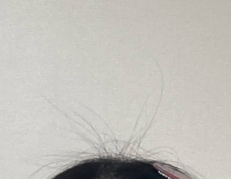 [잡담] 정수리 더듬이 이거 어떻게 정리해 | 인스티즈