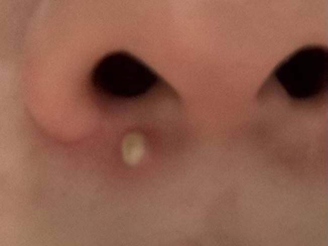 [잡담] 나 트러블 띨롱 하나 난 거 볼 사람^^...ㅋㅋㅋㅋㅋㅋㅋㅋㅋㅋㅋ | 인스티즈