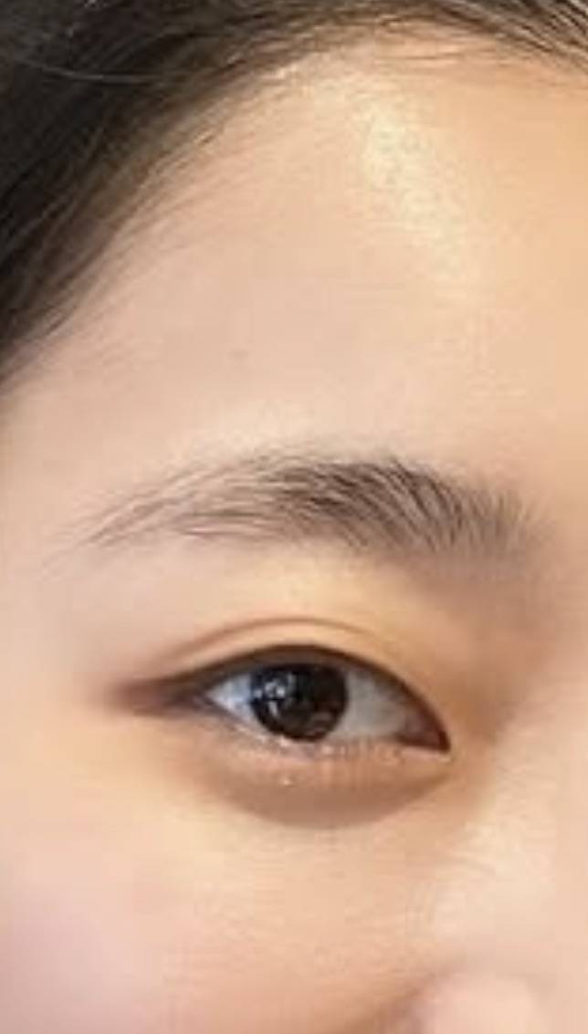 [잡담] 쌍수 할까? | 인스티즈