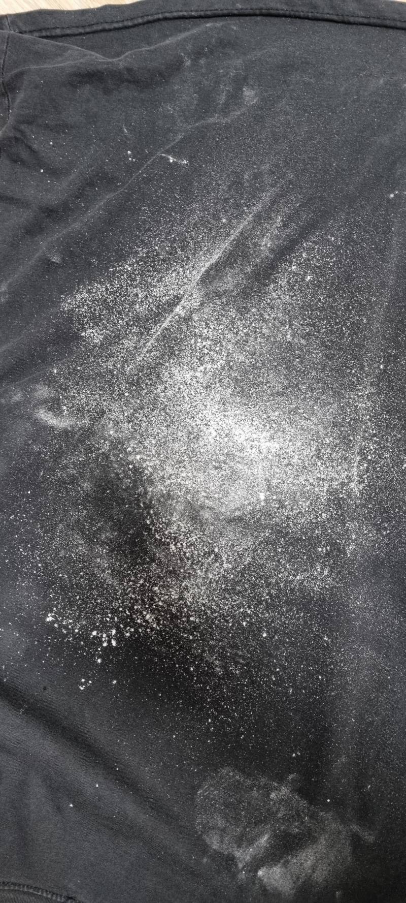 [잡담] 혐오주의 나 발 각질 밀엇는데 이거맞음? | 인스티즈