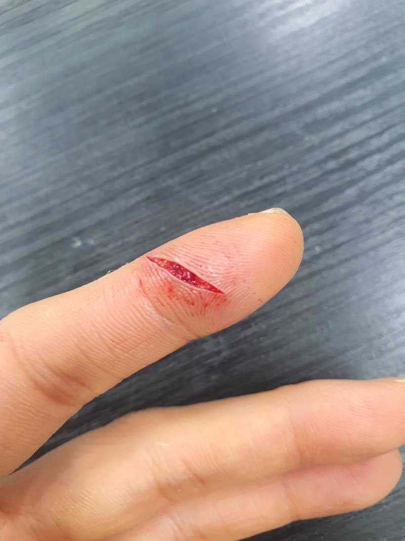 [잡담] [ㅎㅇㅈㅇ] 칼에 손가락을 베였어 | 인스티즈