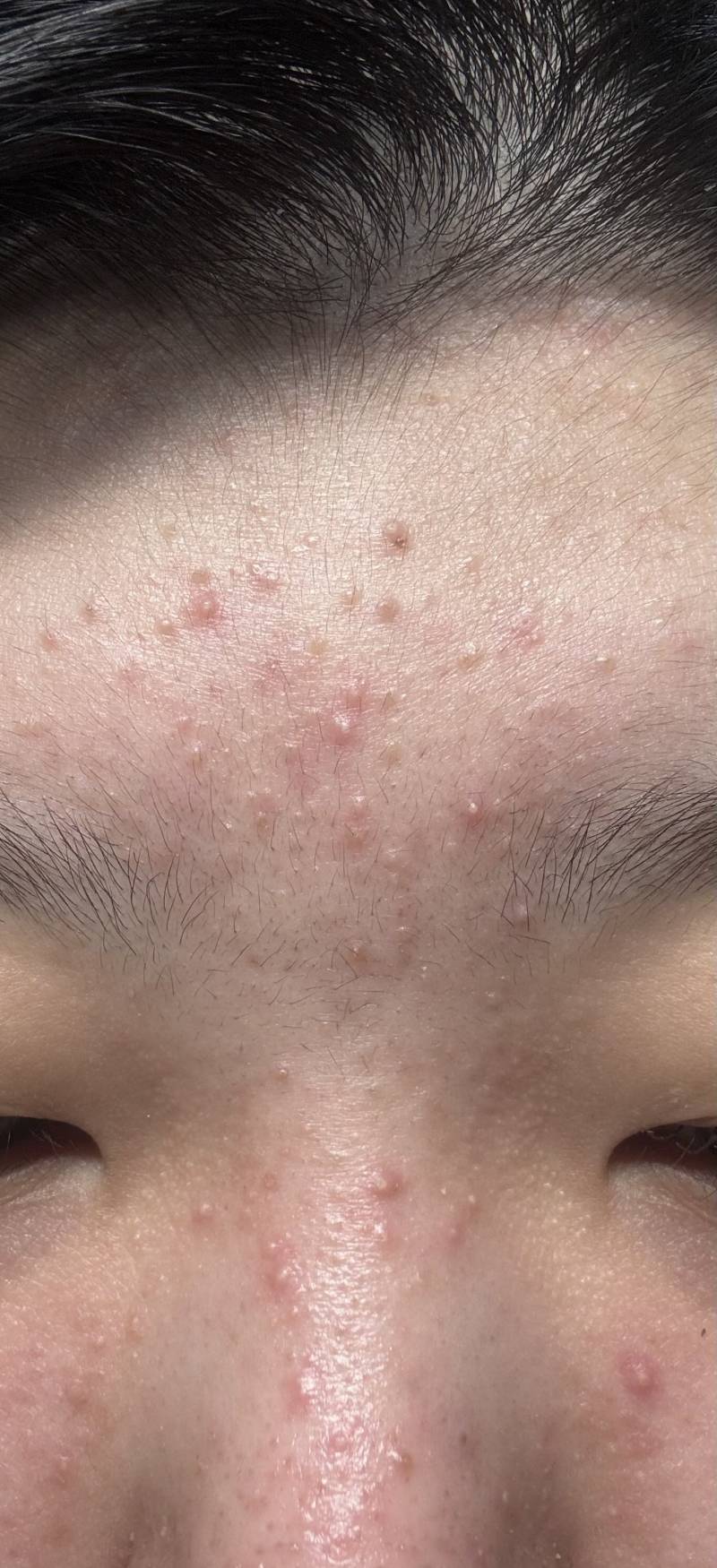 [잡담] 피부에 이거 진짜 뭐야??? | 인스티즈