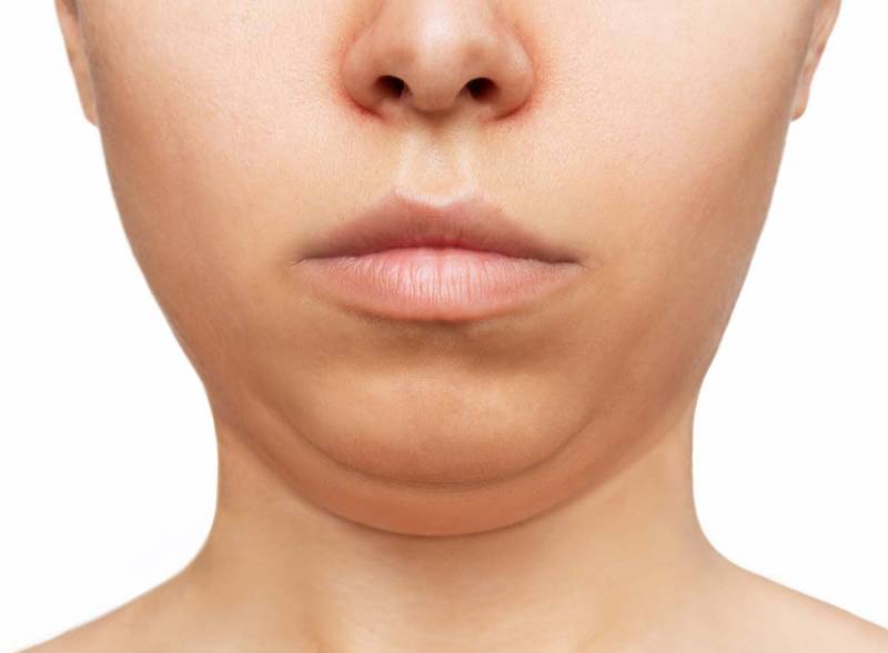 [잡담] 날씬한데 턱만 이런 거면 | 인스티즈