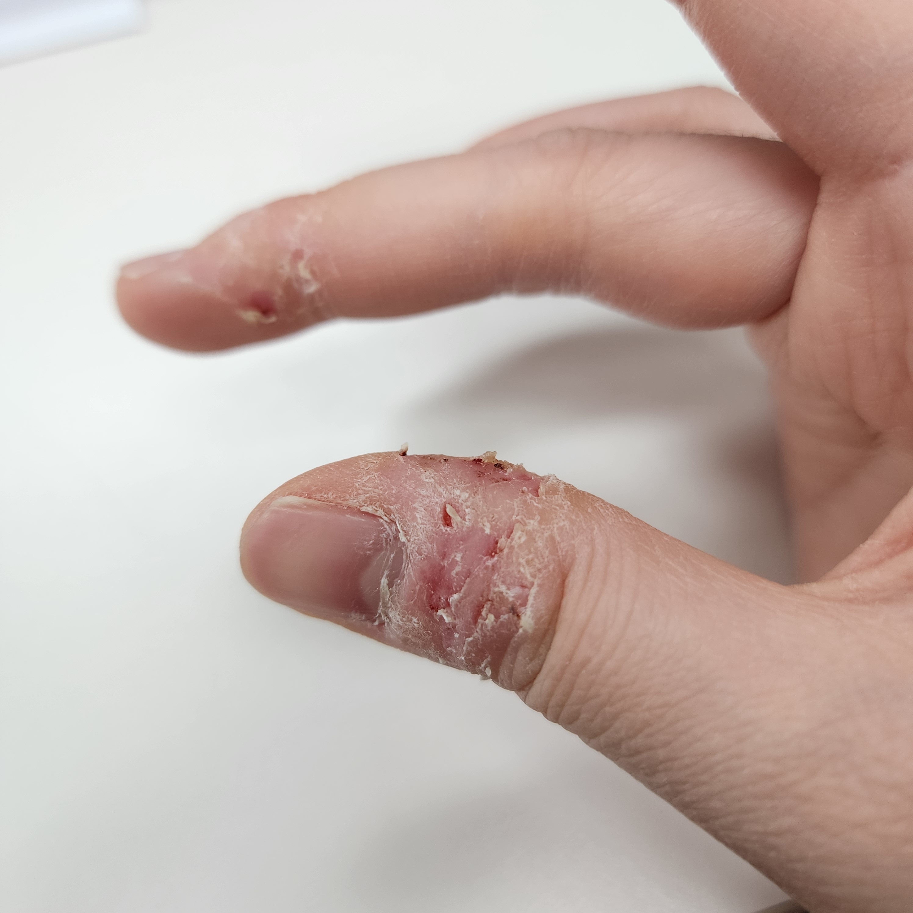 [잡담] 내 손... (혐오주의 | 인스티즈