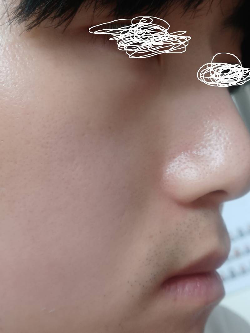 [잡담] 레티놀 10년차 후기(인증) | 인스티즈