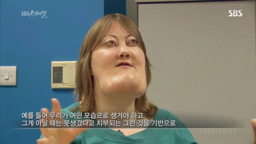 기형적 턱을 가진 여자 비키 라이트가 성형수술을 하지 않는 이유 | 인스티즈