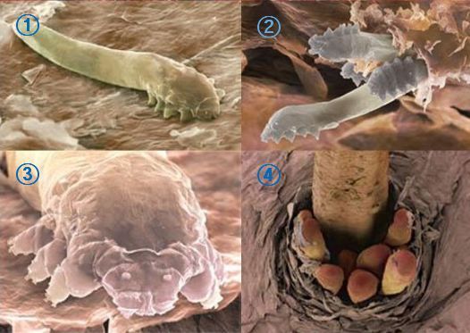 화장하고나서 눈썹이나 속눈썹이 가려운이유 (혐오주의) | 인스티즈