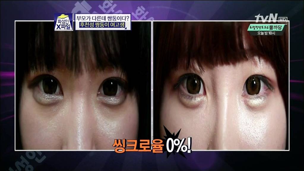 [화성인X파일] 후천성 쌍둥이 여고생 | 인스티즈