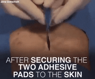 3M 수술 봉합용 테이프.gif (혐오주의) | 인스티즈