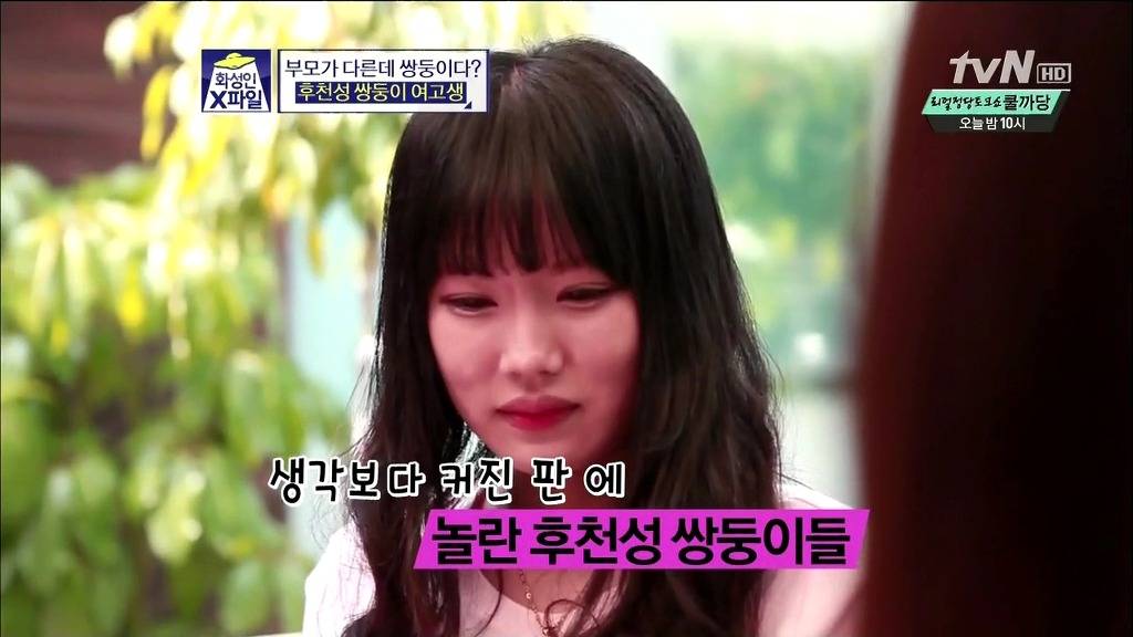 [화성인X파일] 후천성 쌍둥이 여고생 | 인스티즈