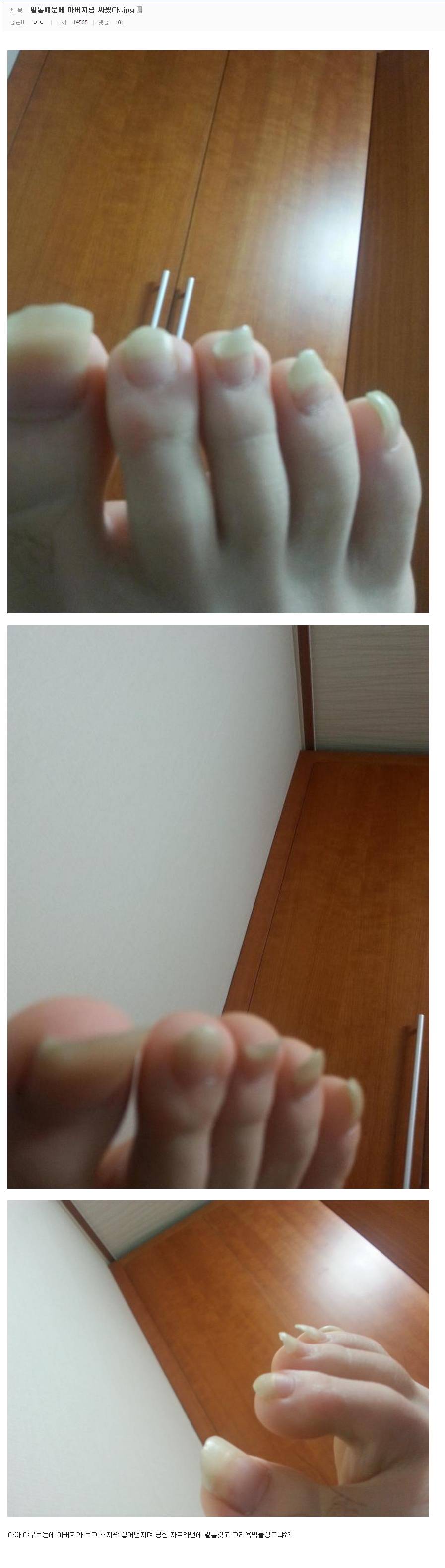 발톱때문에 아버지랑 싸운 디씨인.jpg (혐오주의) | 인스티즈