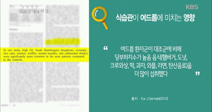 자취를 시작하고 여드름이 악화되었다.jpg | 인스티즈