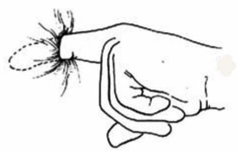 항문외과 가기 꺼리는 이유.jpg | 인스티즈