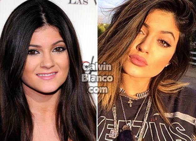 성형수술 하나만 했는데 엄청 인기 많아진 여자연예인 | 인스티즈