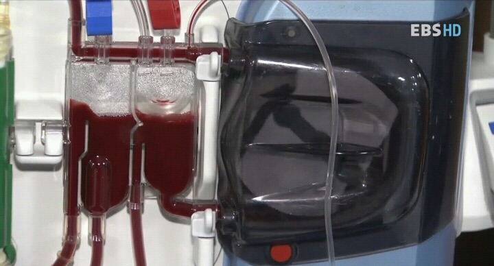 신장병을 초기에 아는 것은 아주 중요하다.jpg | 인스티즈