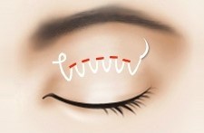 쌍수한 사람들이 가끔 꾸는 꿈 | 인스티즈