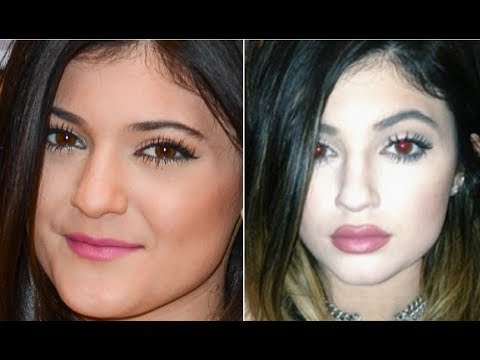 성형수술 하나만 했는데 엄청 인기 많아진 여자연예인 | 인스티즈