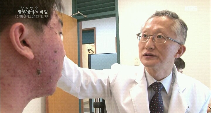 자취를 시작하고 여드름이 악화되었다.jpg | 인스티즈