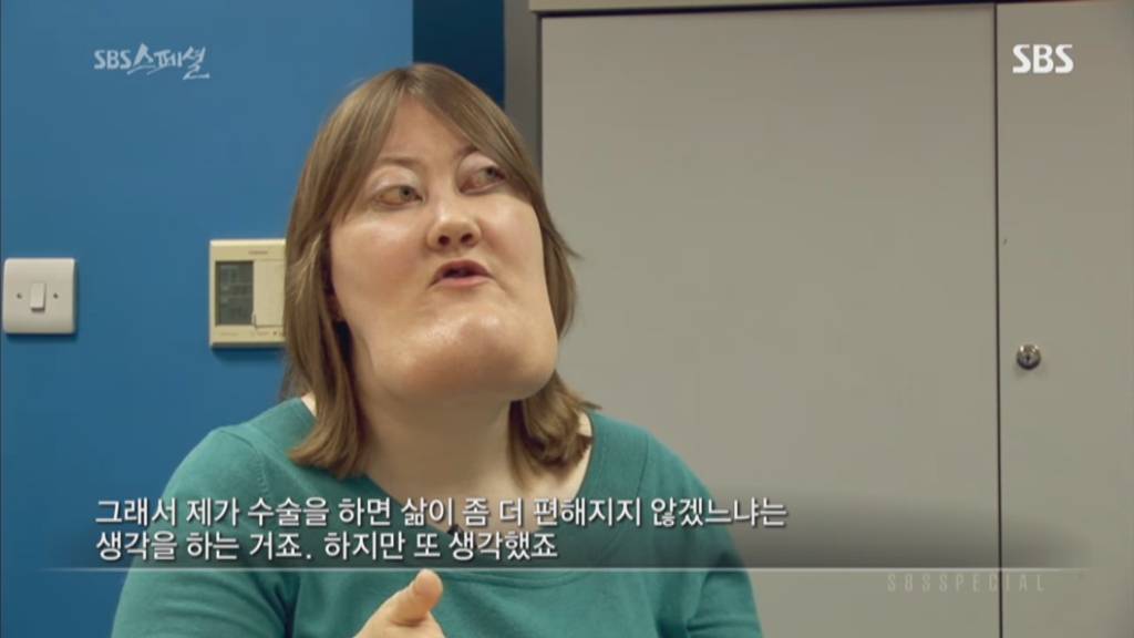 기형적 턱을 가진 여자 비키 라이트가 성형수술을 하지 않는 이유 | 인스티즈