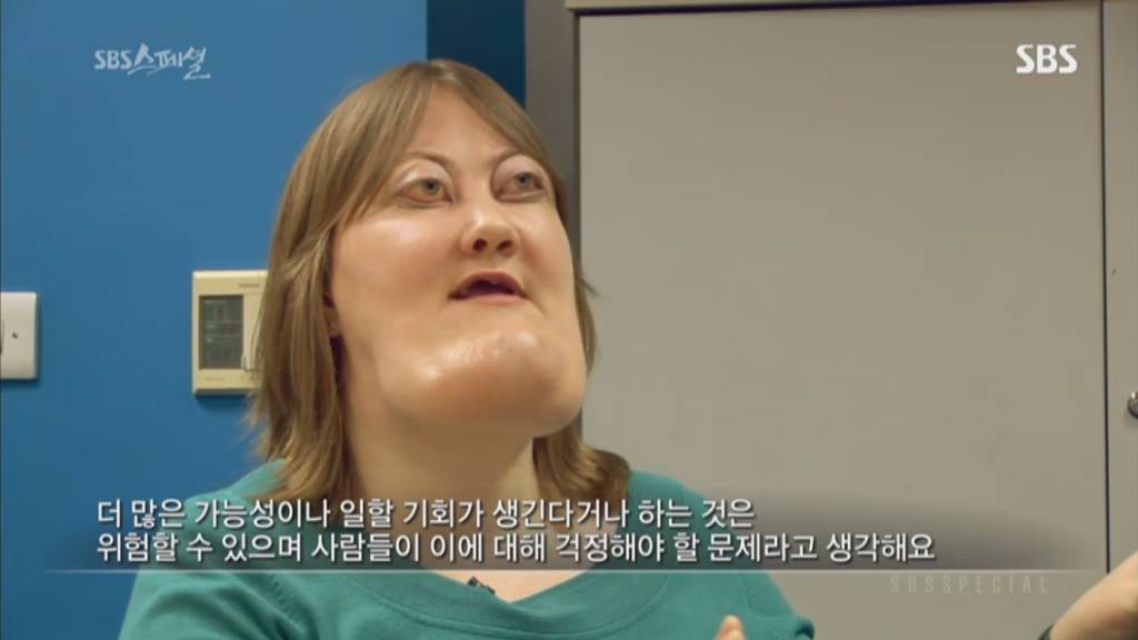 기형적 턱을 가진 여자 비키 라이트가 성형수술을 하지 않는 이유 | 인스티즈