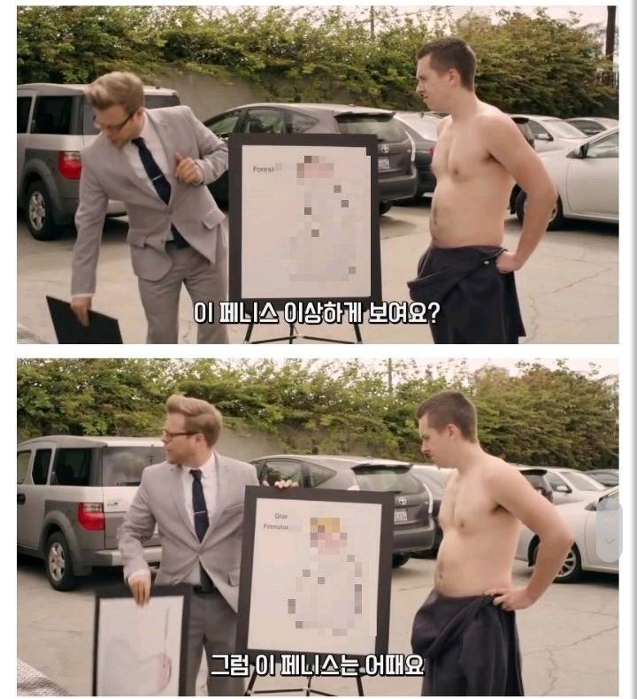 미국에서 포경수술을 많이 하는 이유 | 인스티즈