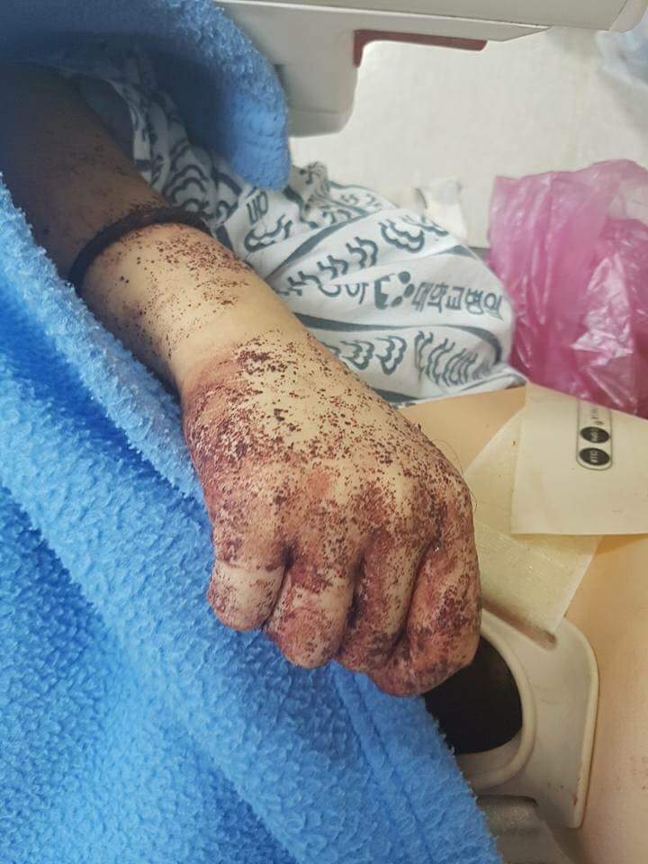 부산 여중생 폭행사건, 2차 보복범죄 + 야간 흉기 집단폭행 | 인스티즈